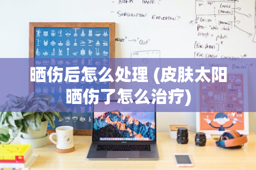 晒伤后怎么处理 (皮肤太阳晒伤了怎么治疗)
